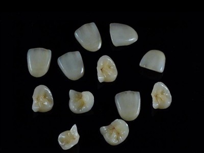 Kuinka valita paras hammasliima kruunuille: uusin opas