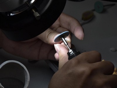 Kuinka kauan PFM-kruunut kestävät? Keskimääräinen elinikä, tekijät ja hoitovi...