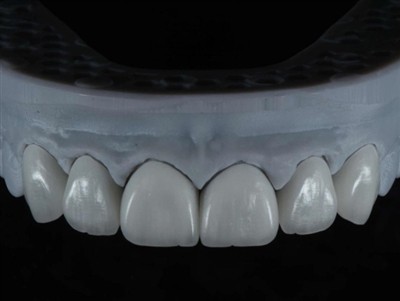 Hammaslaboratorioteknikon työn ulkoistaminen ulkomaille: Kattava opas